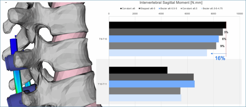 Spine Rod Position SRI Announces Spinal Fixation Rod with Bezier Surface Geometry